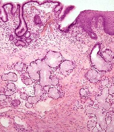 Исследование роли сероводорода в цитопротекции