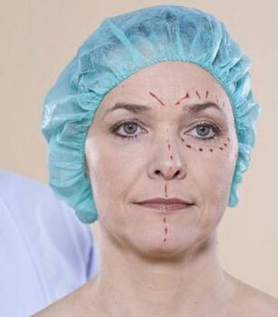 Как выбрать клинику и пластического хирурга? - Назар Грицевич во Львове