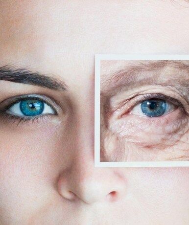 Реабилитация после блефаропластики