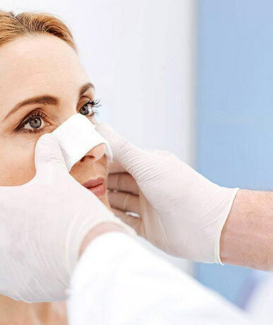 Можно ли курить после ринопластики?