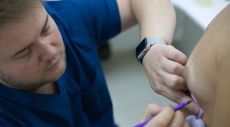 Консультація пластичного хірурга