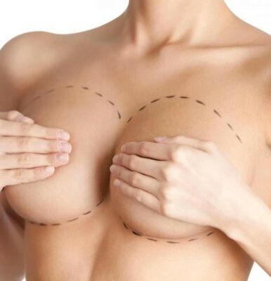 Как подготовиться к операции по увеличению груди