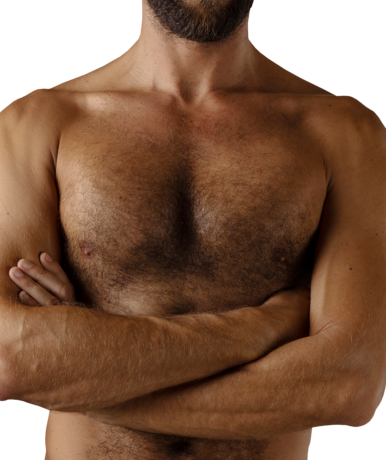 Лечение гинекомастии - Назар Грицевич во Львове