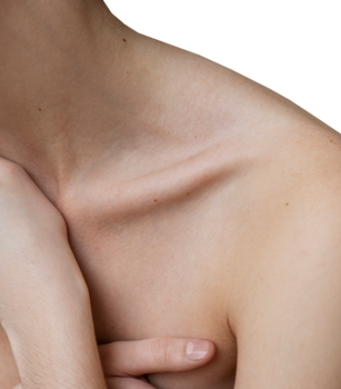 Коррекция рубцов Коррекция рубцов - Назар Грицевич во Львове