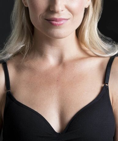 Пластика сосков и ареол в Луцке - Назар Грицевич во Львове